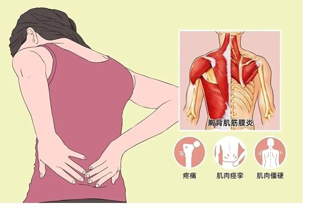 肌肉骨骼系統疼痛