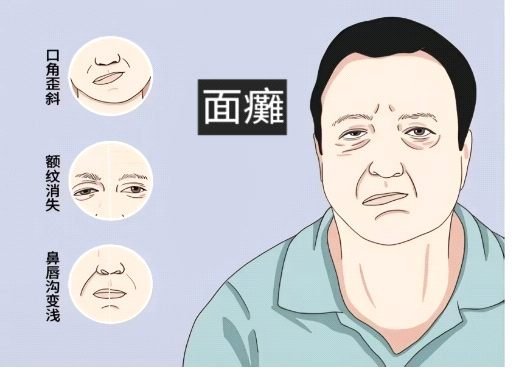 神經系統疾病