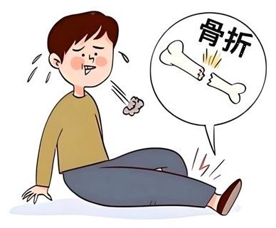 各類骨折