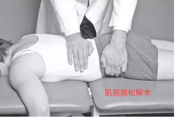 肌筋膜釋放