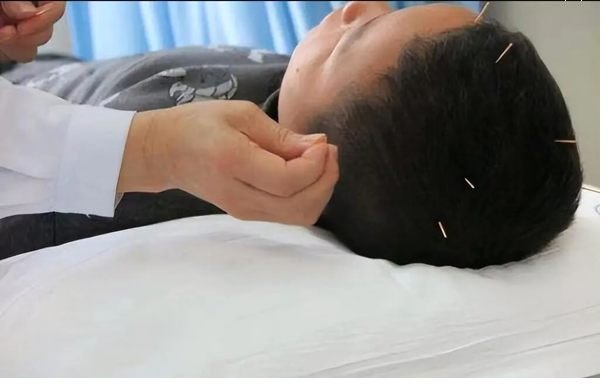 功能性電刺激誘發肌肉收縮